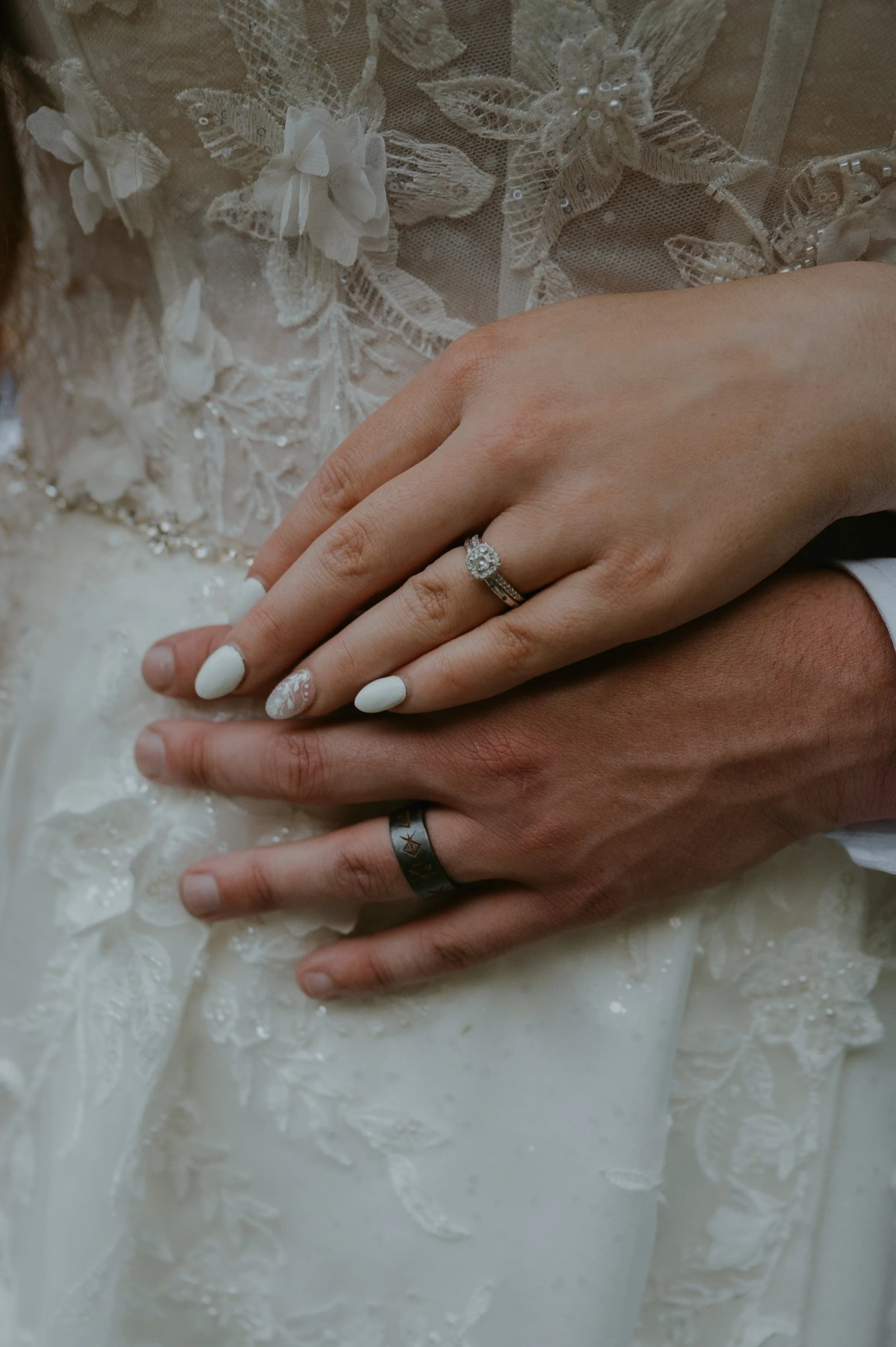 Two hands with wedding rings rest on white lace